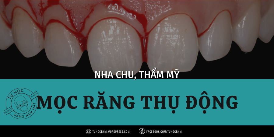 Rối Loạn Cơ Nhai & TMJ: Chẩn Đoán, Co Thắt, Đau Cân Cơ (2026)
