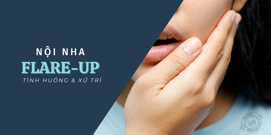 Xử trí Flare-up nội nha: Khi nào cần rạch dẫn lưu, khi nào dùng kháng sinh?