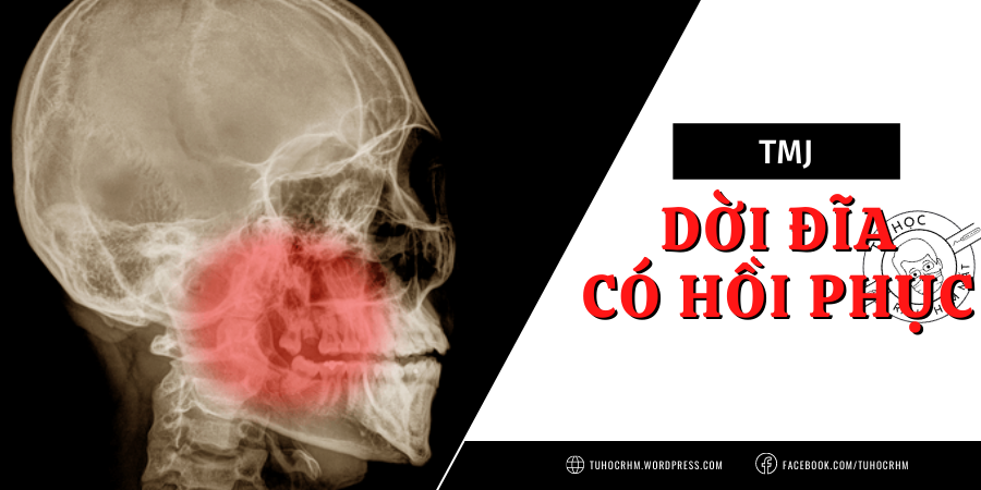 TMJ: Điều Trị Dời Đĩa (Trật Đĩa Khớp) Có Hồi Phục Hiệu Quả (2026)