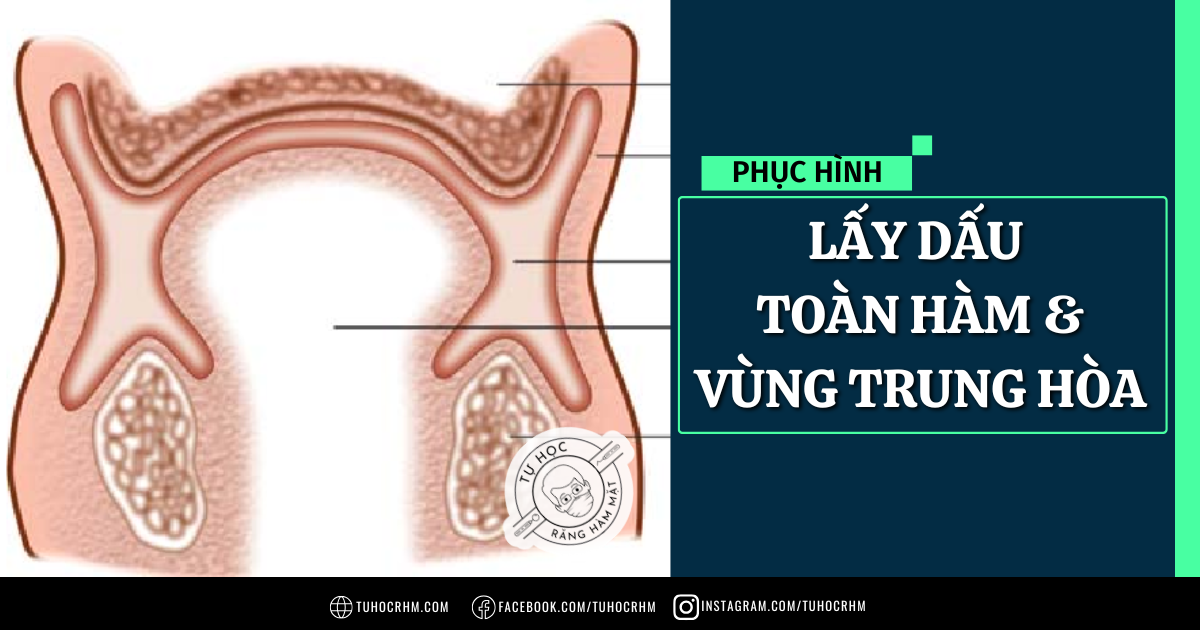 Hướng Dẫn Lấy Dấu Toàn Hàm & Xác Định Vùng Trung Hòa (2026)