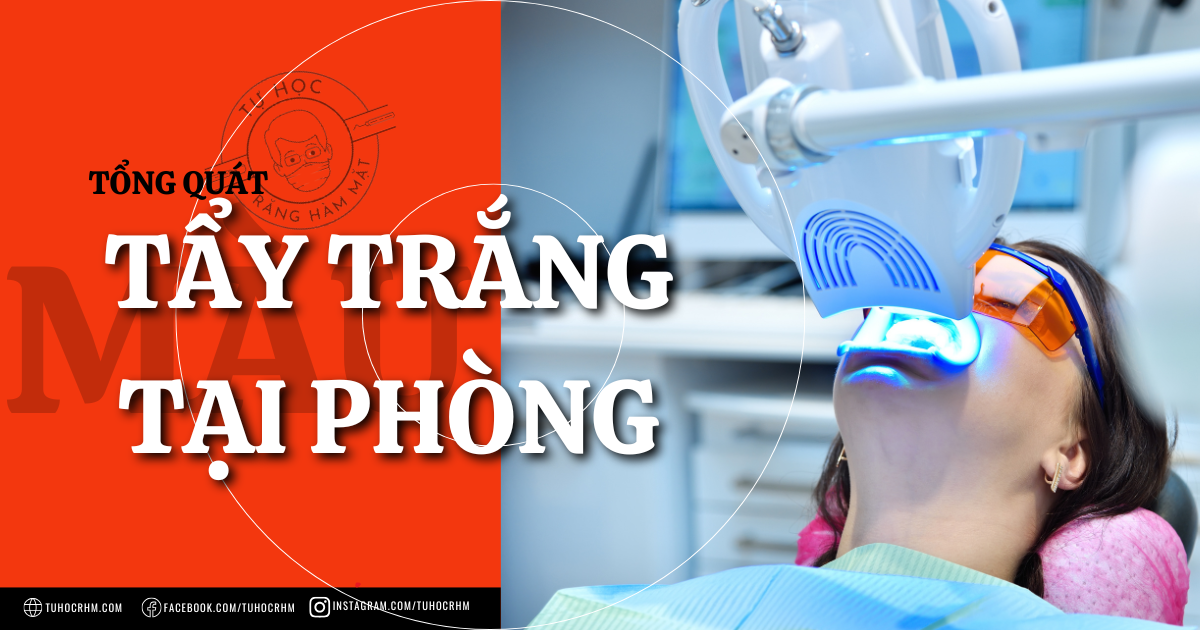 Tẩy Trắng Răng Tại Phòng Khám: Quy Trình & Cách Giảm Ê Buốt (2026)