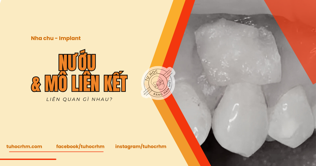 Nướu Và Mô Liên Kết: Giải Phẫu, Mô Học & Sinh Lý Học (2026)