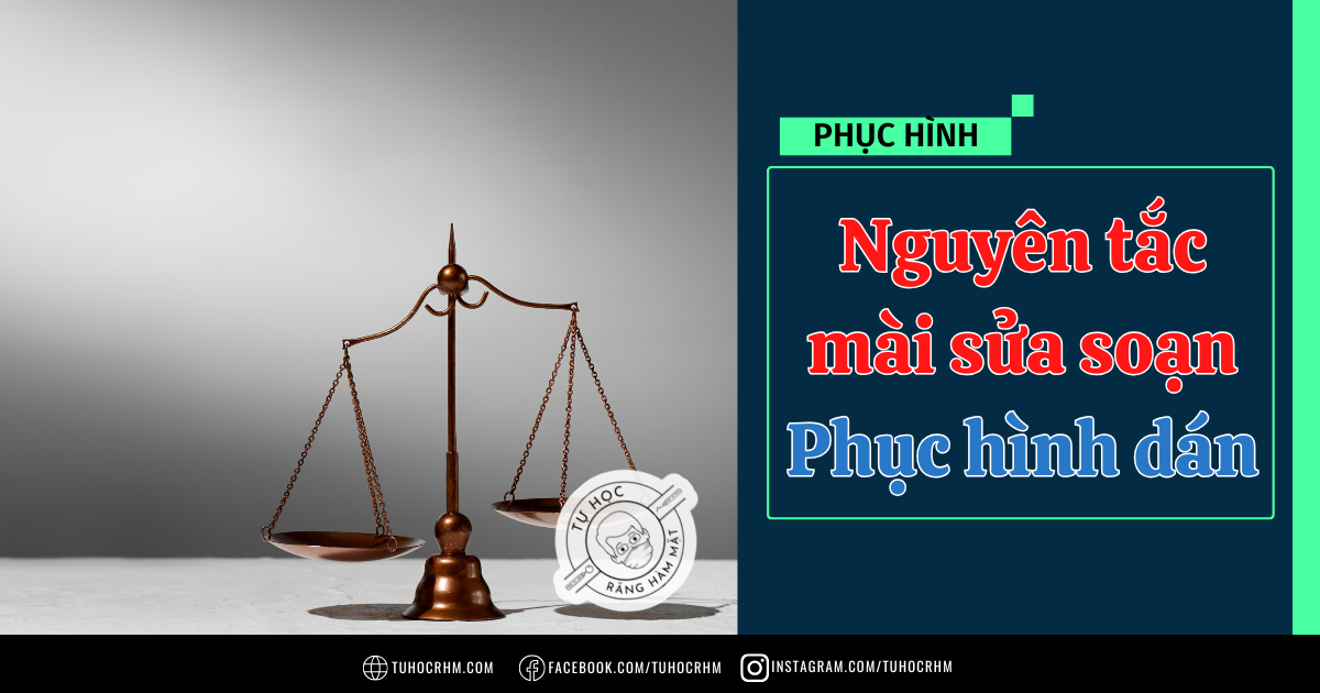 5 Nguyên Tắc Phục Hình Dán Trên Nướu Chuẩn Y Khoa (2026)