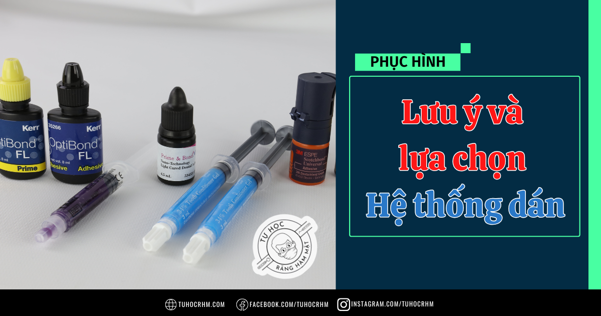 Các Hệ Thống Dán Nha Khoa: Lưu Ý Lâm Sàng & Kỹ Thuật (2026)