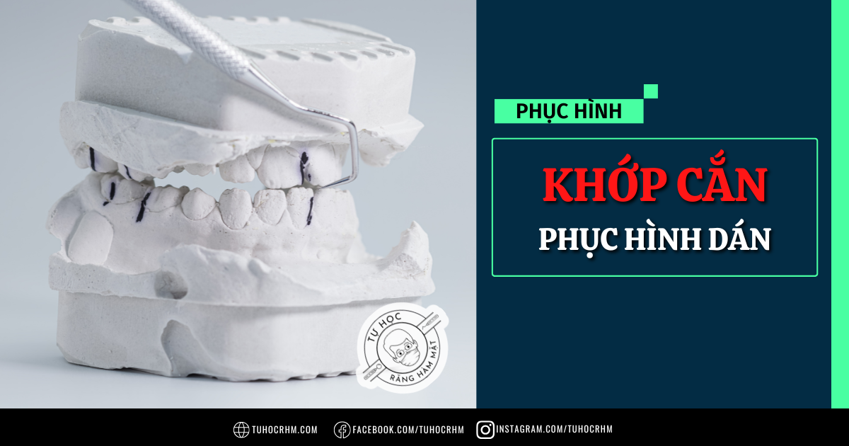 Phục Hình Và Khớp Cắn: 7 Dấu Hiệu Bệnh Lý & 3 Quy Tắc Vàng (2026)