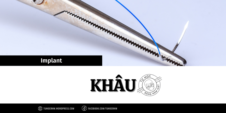 Hướng Dẫn Kỹ Thuật Khâu Trong Implant & Ghép Xương (2026)