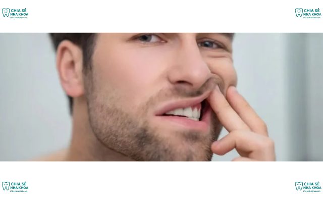 Tụt Lợi Chân Răng Có Chữa Được Không? 4 Cách Chữa Hiệu Quả