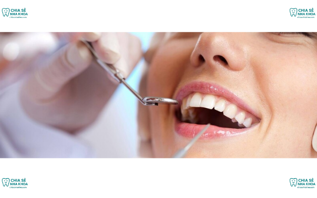 Kinh Nghiệm Chăm Sóc Răng Sứ An Toàn Sau Khi Bọc Đúng Cách