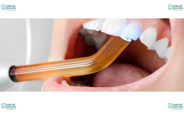 Trám Răng Thẩm Mỹ Khác Gì Trám Răng Thông Thường? (2026)