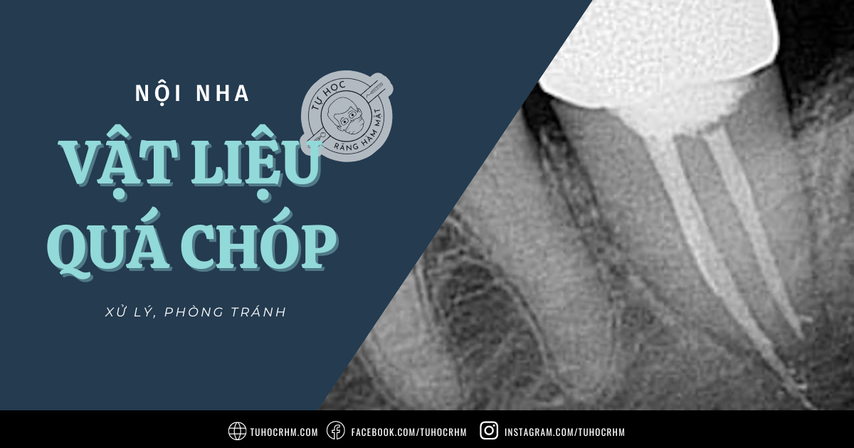 Dị Ứng Phản Vệ Thuốc Tê: Dấu Hiệu, Cơ Chế & Phác Đồ Cấp Cứu (2026)