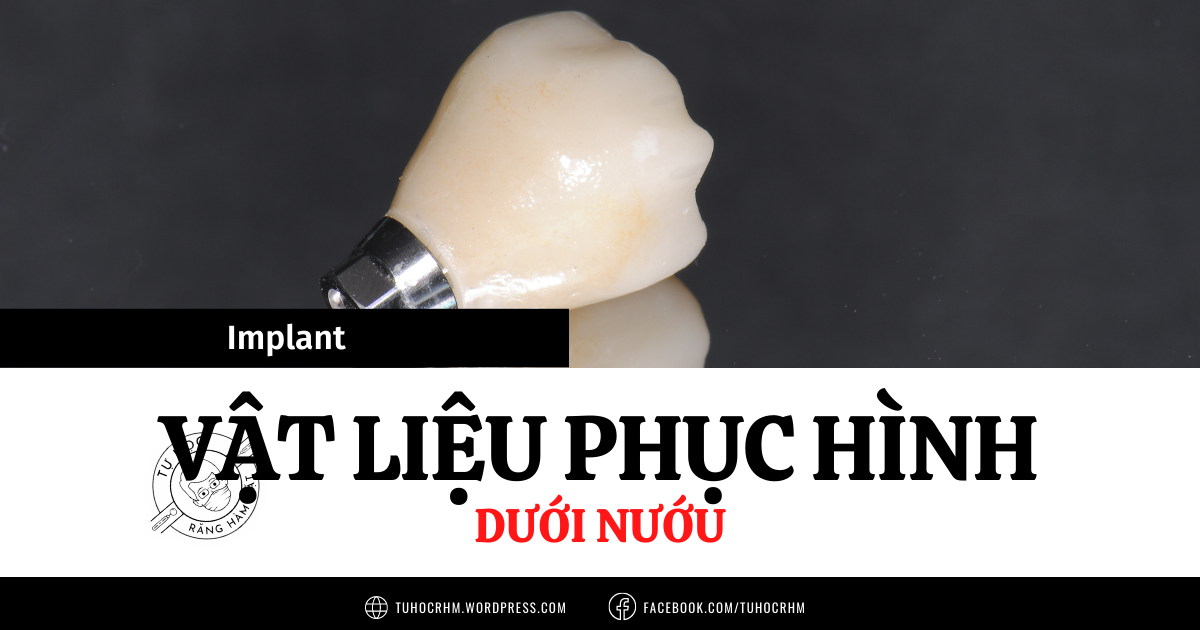 Vật Liệu Phục Hình Implant Dưới Nướu: Zirconia, Titanium Hay Sứ Đắp?