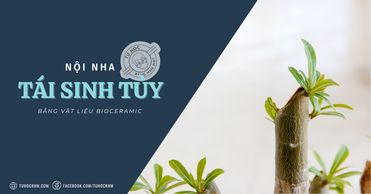 Tái Sinh Tủy Bằng Bioceramic: Quy Trình & Đặc Tính Vật Liệu (2026)